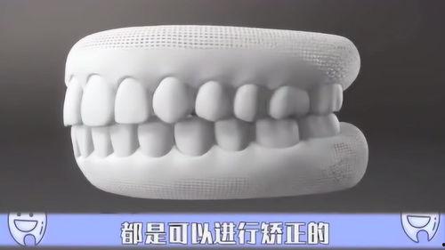 成人能做牙齿矫正吗视频,改变笑容，重拾自信之旅
