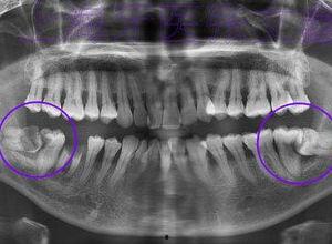 成人磨牙实录视频播放网站,深夜磨牙背后的秘密